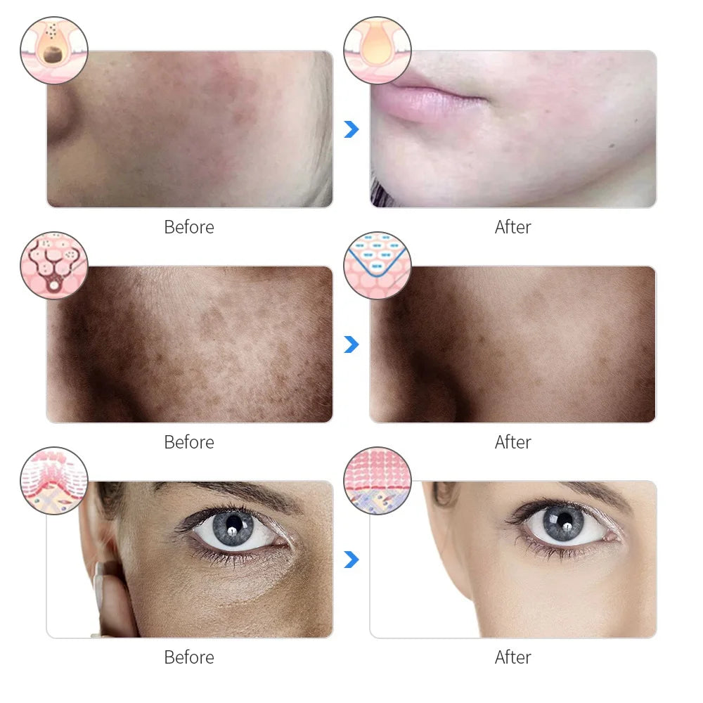 Rechargeable 7-Color LED Facial Mask – Skin Rejuvenation, Anti-Aging & Face Lifting Light Therapy