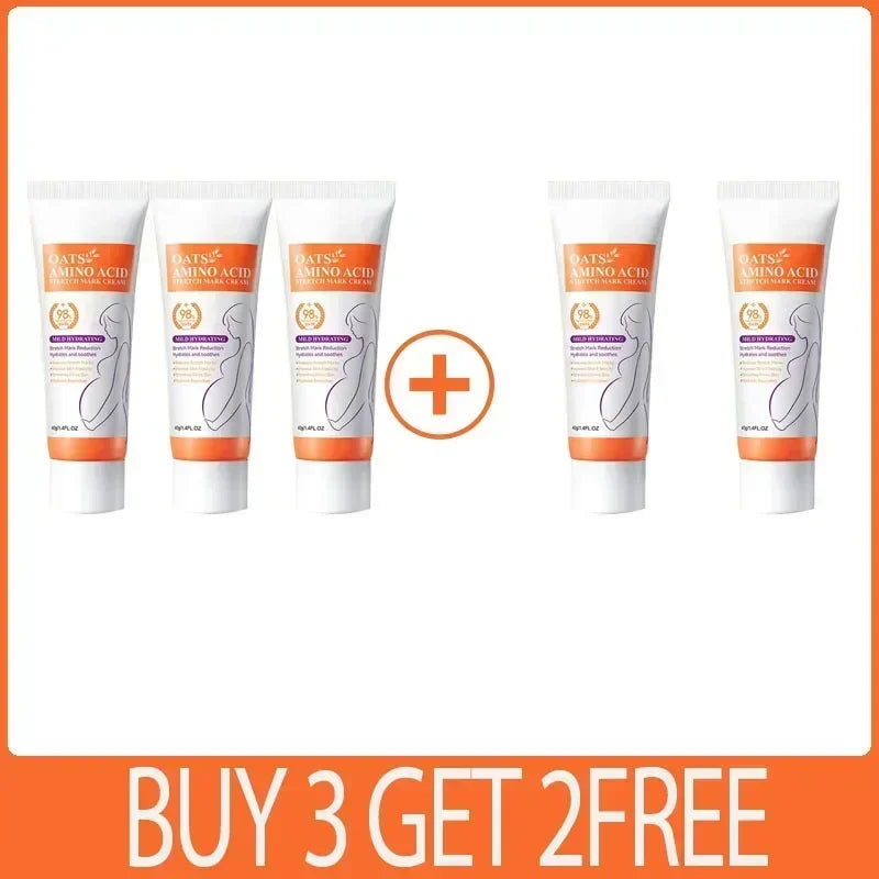 Stretch Mark Care Cream – Helps Improve Skin Texture, Firmness & Elasticity