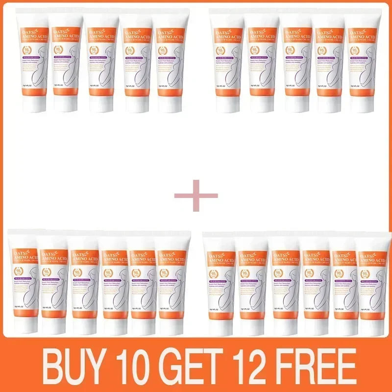 Stretch Mark Care Cream – Helps Improve Skin Texture, Firmness & Elasticity