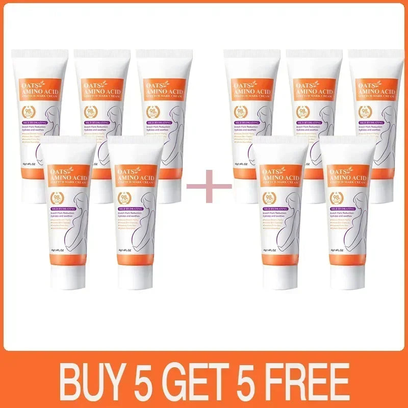 Stretch Mark Care Cream – Helps Improve Skin Texture, Firmness & Elasticity