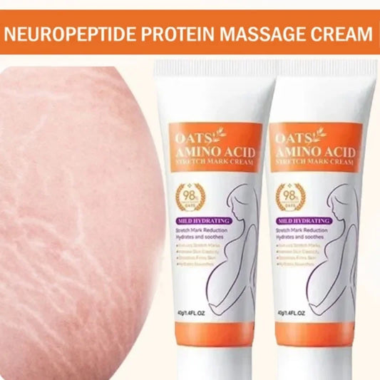Stretch Mark Care Cream – Helps Improve Skin Texture, Firmness & Elasticity